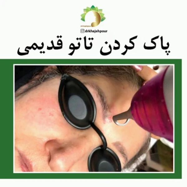 دکتر نیلوفر خواجه پور | پزشک جوانسازی پوست در اصفهان | جوانسازی صورت اصفهان