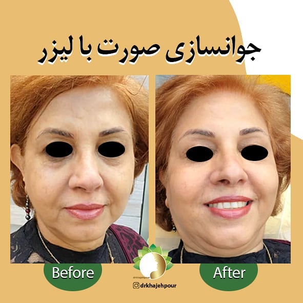 معروف ترین دکتر پوست و مو و زیبایی در اصفهان