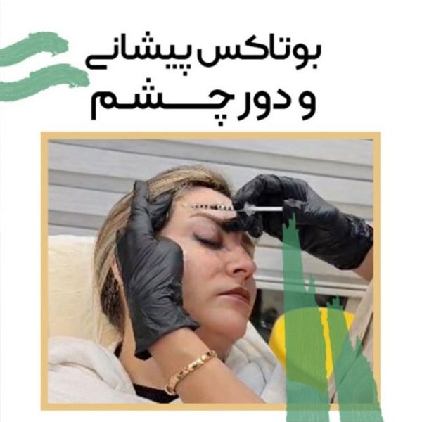 بوتاکس پیشانی