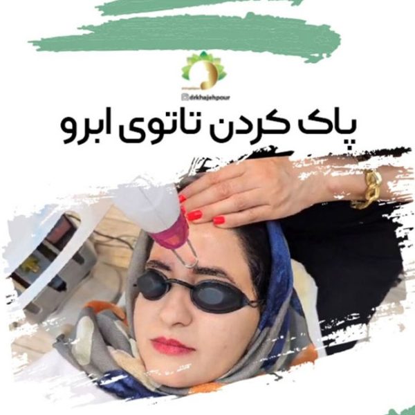 پاک کردن تاتو ابرو